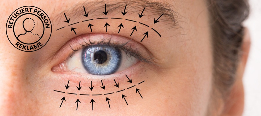 Øyelokkoperasjon-oslo