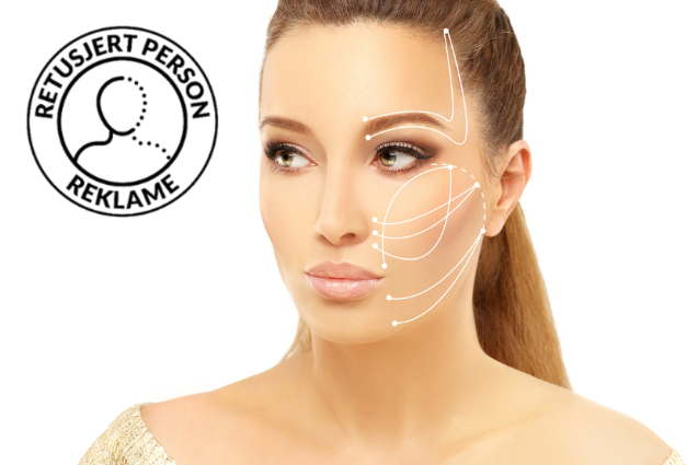 Kvinne som viser mulige trådløft markeringer på ansiktet for estetisk kirurg