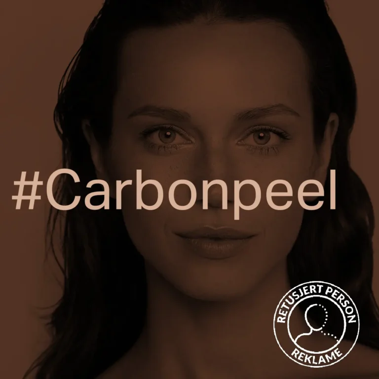 Carbon peel