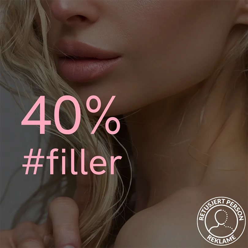 40% rabatt på leppefiller